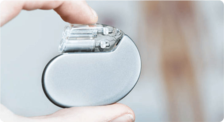 Traditional Pacemaker Device - Heart Rhythm Treatment